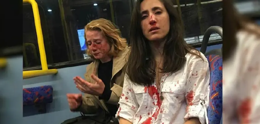 Londra, coppia lesbica pestata da gruppo di bulli
