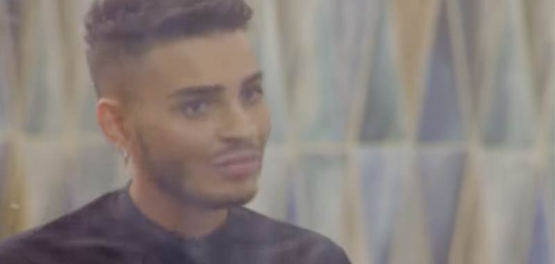 Cristian Imparato finalmente ammette il ricorso al ritocchino