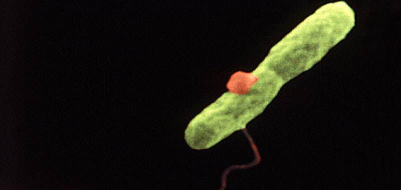 Legionella sintomi e quali rischi comporta