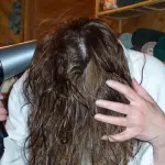 Metformina una delle cause della perdita di capelli