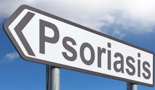 La psoriasi può davvero aumentare il rischio di colite ulcerosa?