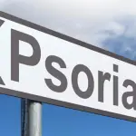 La psoriasi può davvero aumentare il rischio di colite ulcerosa?