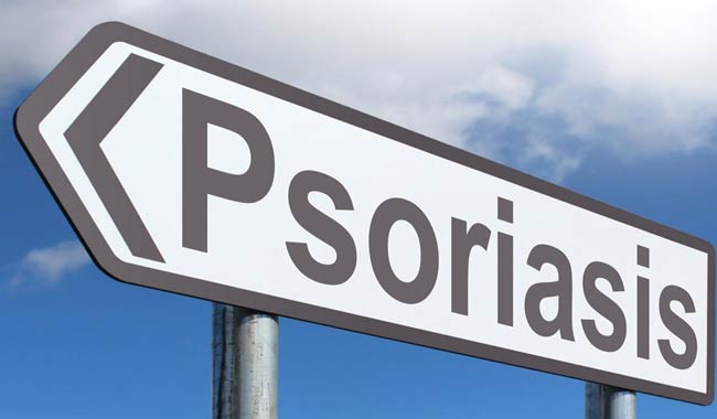 La psoriasi può davvero aumentare il rischio di colite ulcerosa?