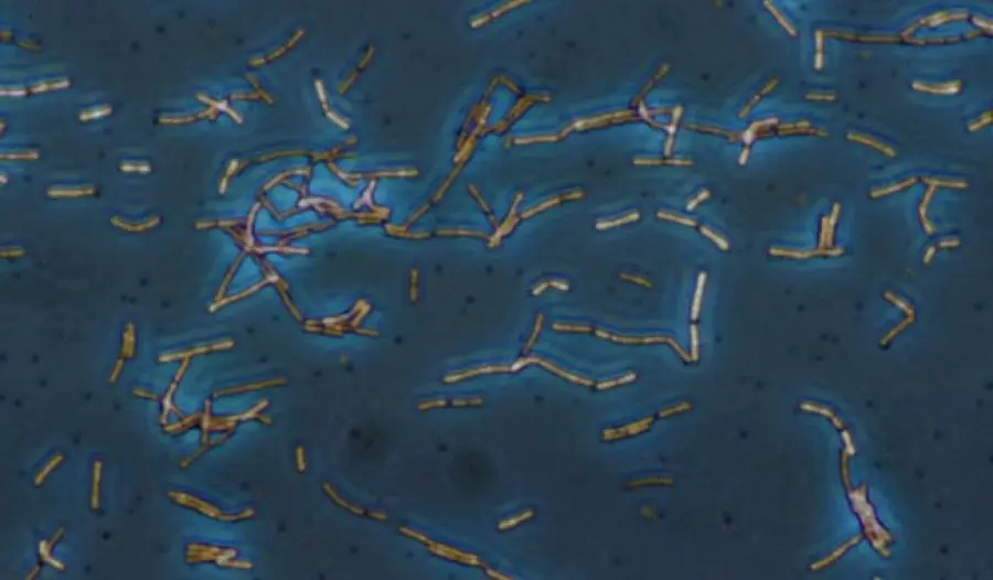 Leucociti alti non solo nelle urine, che cosa significa?