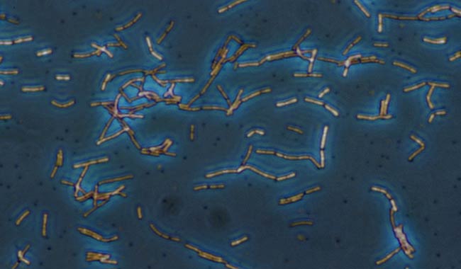 Leucociti alti non solo nelle urine, che cosa significa?