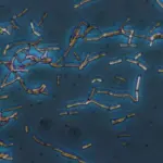 Leucociti alti non solo nelle urine, che cosa significa?