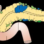 Cosa sono i linfonodi reattivi e come riconoscerli
