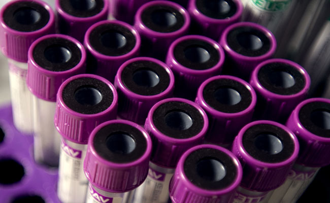 Cos'è invece la Gamma GT Basso