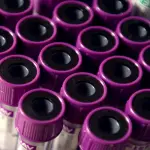 Cos'è invece la Gamma GT Basso