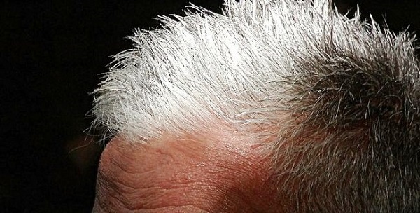 Capelli grigi: maggiore rischio di malattie cardiache?