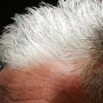 Capelli grigi: maggiore rischio di malattie cardiache?