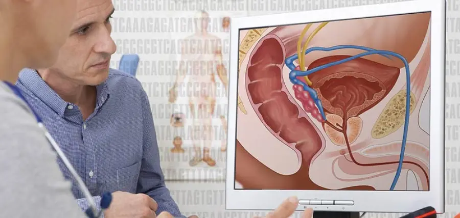 Cancro alla prostata, quali trattamenti sono consigliati?