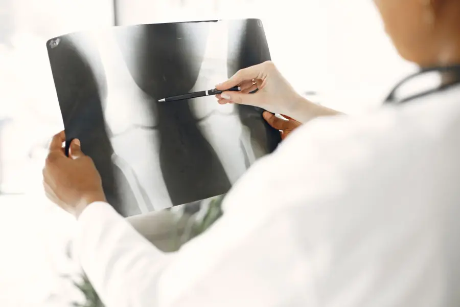 Dalle artrosi alle operazioni: cosa fa l'ortopedico