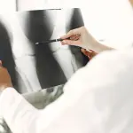 Dalle artrosi alle operazioni: cosa fa l'ortopedico