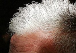 Capelli bianchi maggiore rischio di malattie cardiache