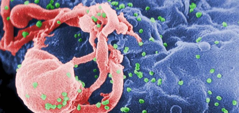 Aids passi da gigante con un vaccino tutto italiano